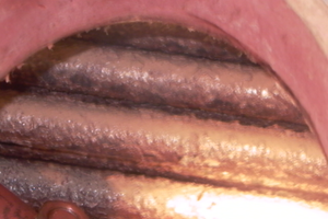 CÁU CẶN VÀ CÁC CHẤT LẮNG ĐỌNG TRONG LÒ HƠI